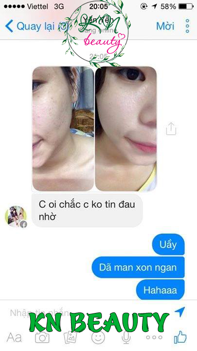đánh giá combo trị nám kn beauty